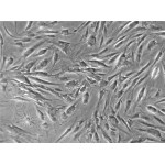 Human Adipose Derived Stem Cells (hADSC, Normal)